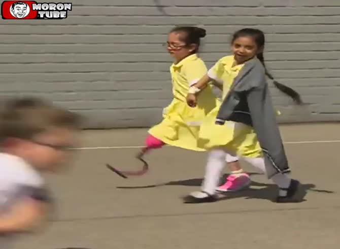 Video :This young girl is overjoyed as she shows her new prosthesis to her classmates